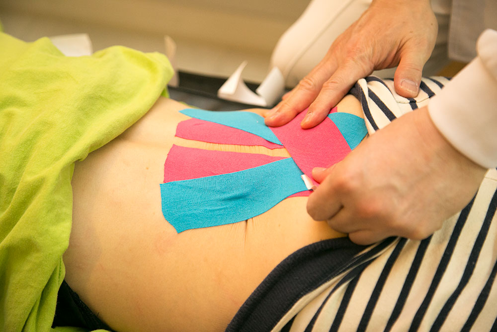 バレエ整体バレエダンサー整体アミカルで、バレエダンサーの腰に、徒手で整えた安定位状態を、教育的に維持するテーピングです。固めるテーピングではなく、安定位置を教育するためのテーピングです。　